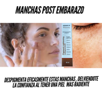 CREMA DESPIGMENTADORA DE MANCHAS , AXILAS Y CODOS:Pigment Lightning S10